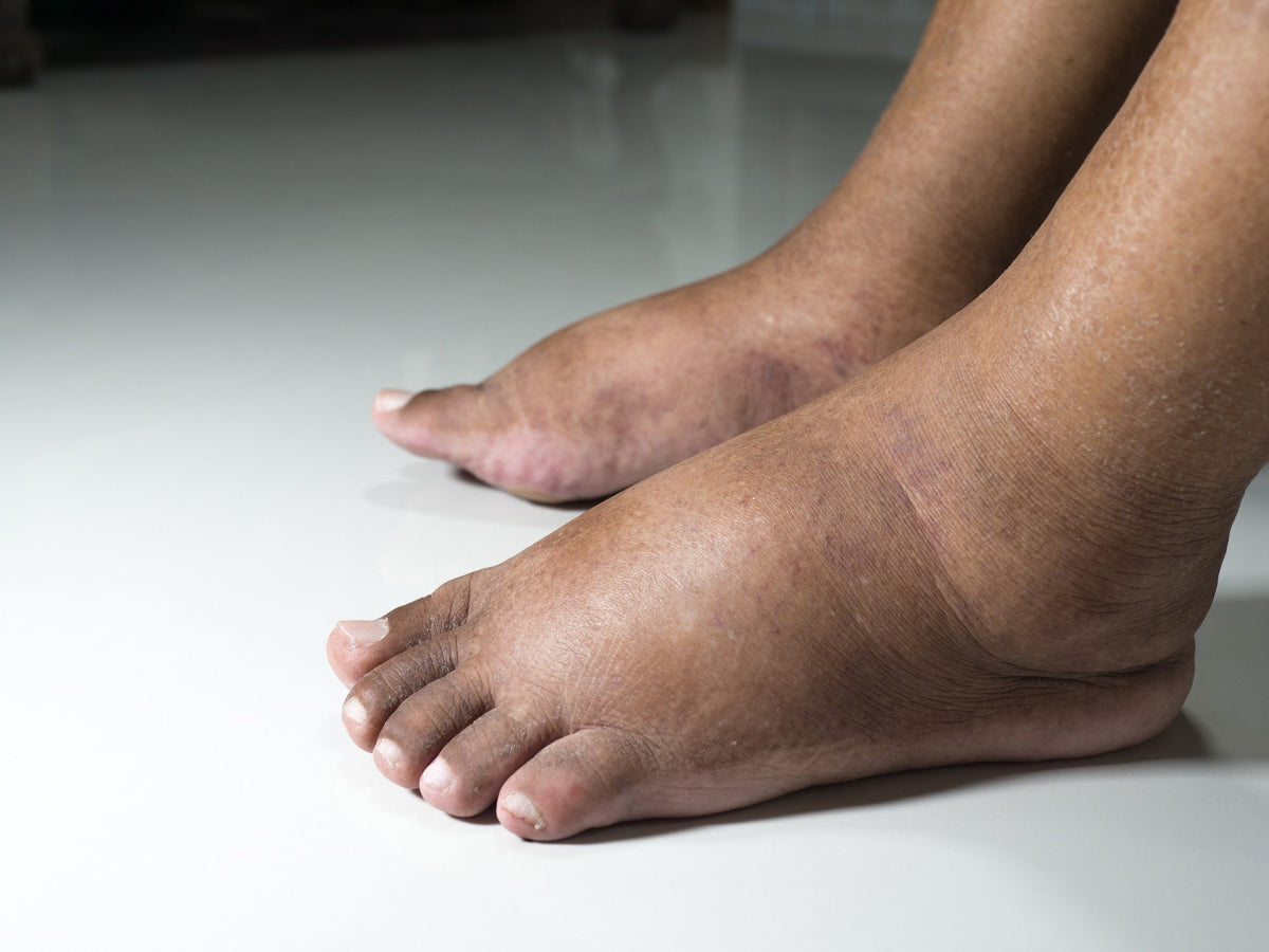Diabetic Foot Pillow Comparison for Better Sleep